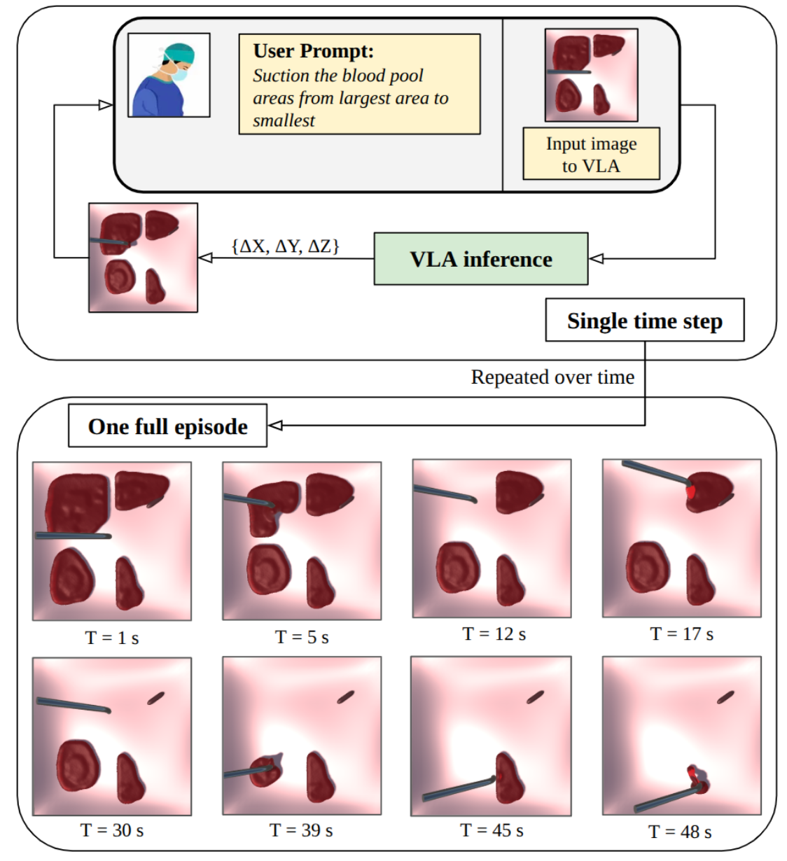 Vision-Language-Action model for autonomous robot-assisted blood suction