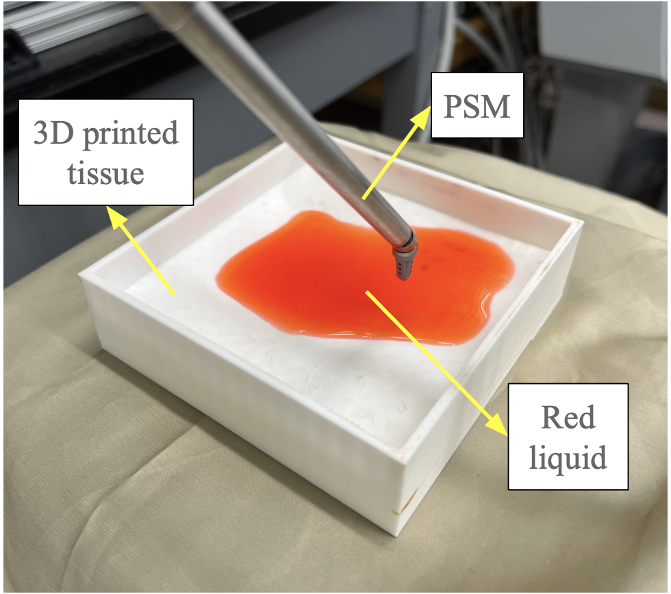Overview of the VLA-controlled blood suction system